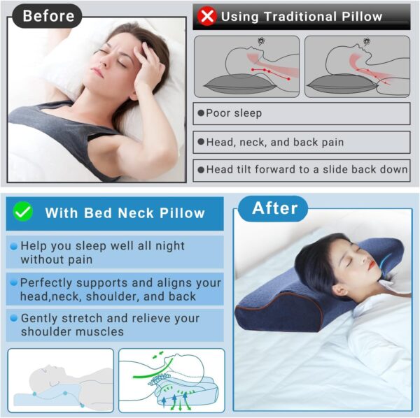 Contour Cervical Neck Pillow - Image 4