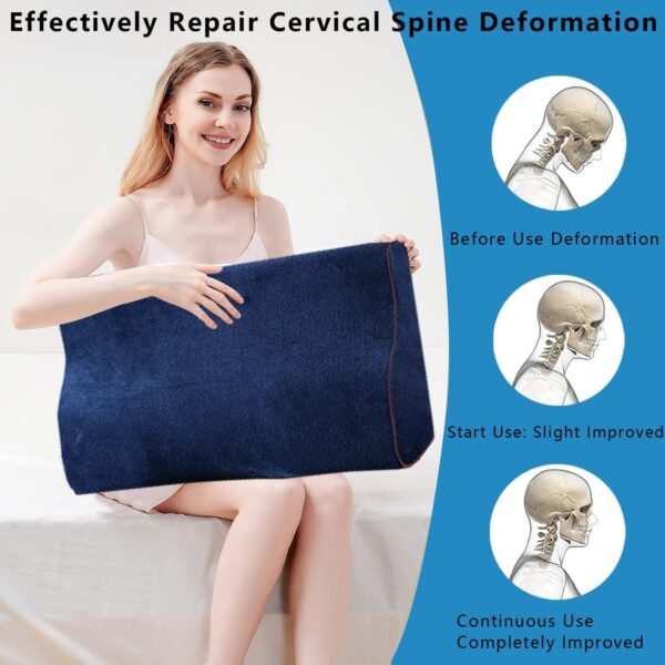 Contour Cervical Neck Pillow - Image 8