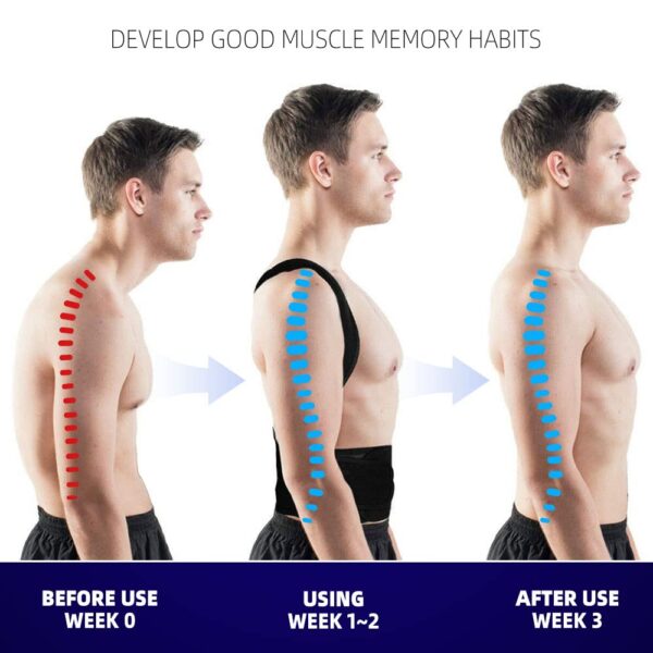 Back Posture Corrector - Image 3