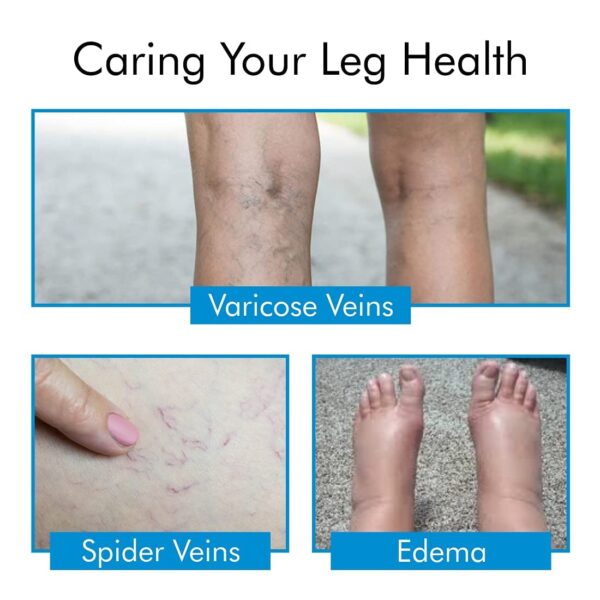 Compression Stockings - Image 3